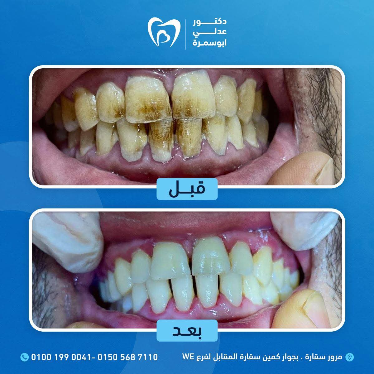 صورة 1